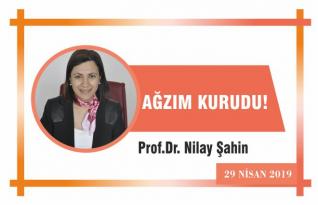 AĞZIM KURUDU!