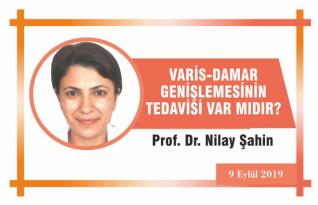 VARİS-DAMAR GENİŞLEMESİNİN TEDAVİSİ VAR MIDIR?